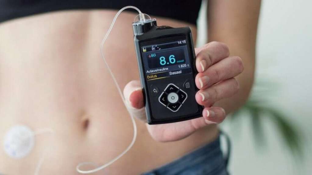 Insulinske pumpe po prvi put besplatne za dijabetičare u Brčko distriktu