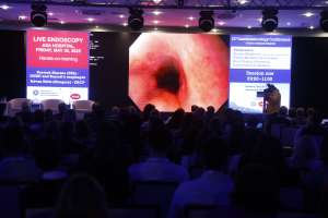 SARAJEVO, 2. juna (FENA) – U okviru 12. Gastroenterološke konferencije, jednog od najznačajnijih stručnih skupova u regiji, ASA Bolnica imala je čast biti domaćin edukativne sesije Live Endoscopy, koju je predvodio prof. dr. Nenad Vanis, međunarodno priznati gastroenterolog, univerzitetski profesor i voditelj Odjeljenja za gastroenterologiju ASA Bolnice. (Foto FENA/Amer Kajmović)